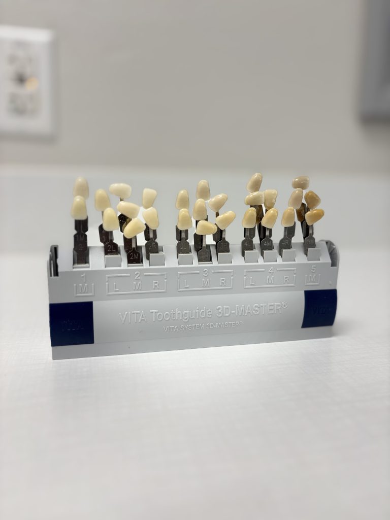 teeth whitening shades at dental office 